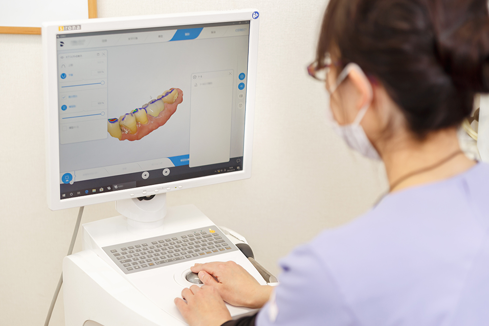 コンピューター上で詰め物や被せ物を綿密に設計できる