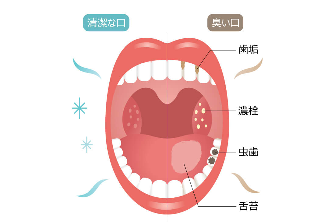 お口のにおいで悩んでいませんか？