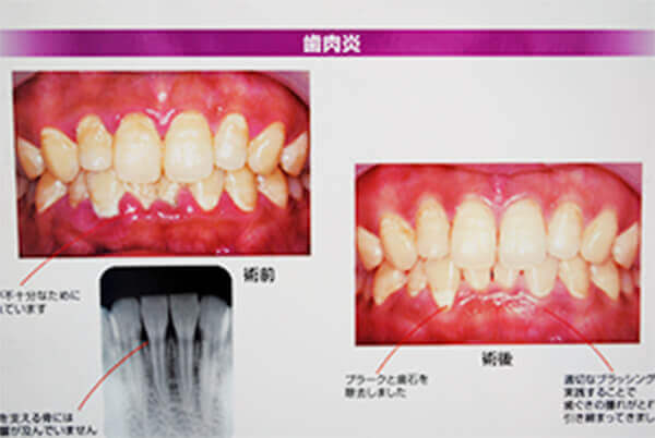 簡易リスク検査の実施（初診時との比較）