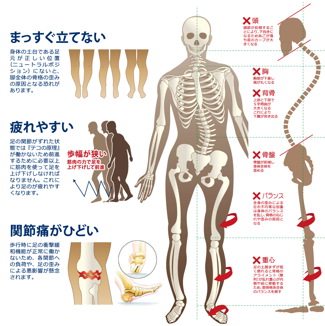 まっすぐ立てない 疲れやすい 関節痛がひどい