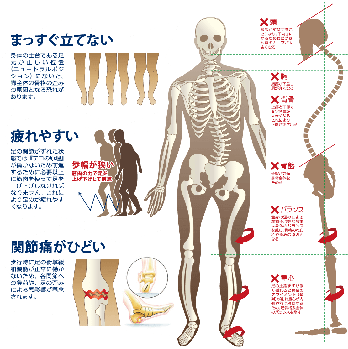 まっすぐ立てない　疲れやすい　関節痛がひどい