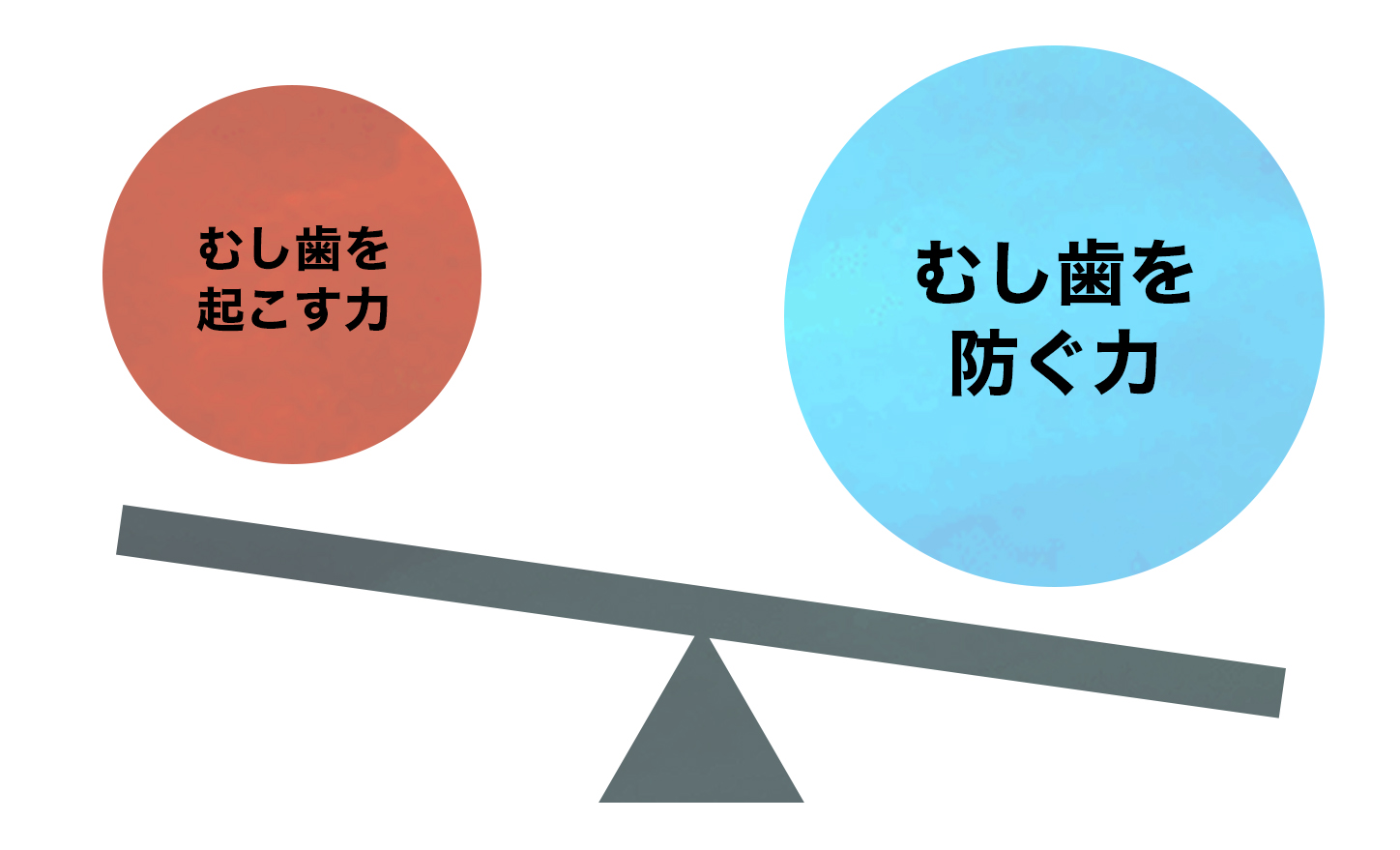 むし歯とは