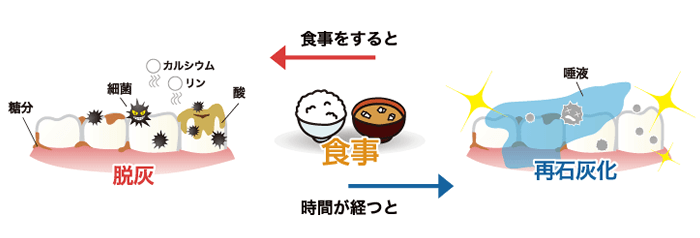 むし歯ってどうなるの?