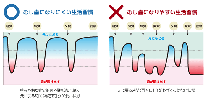 むし歯になりにくい生活習慣