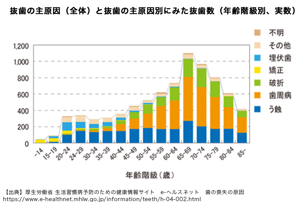 歯の喪失の原因